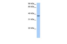 Antibody used in WB on Human Liver at 0.2-1 ug/ml.