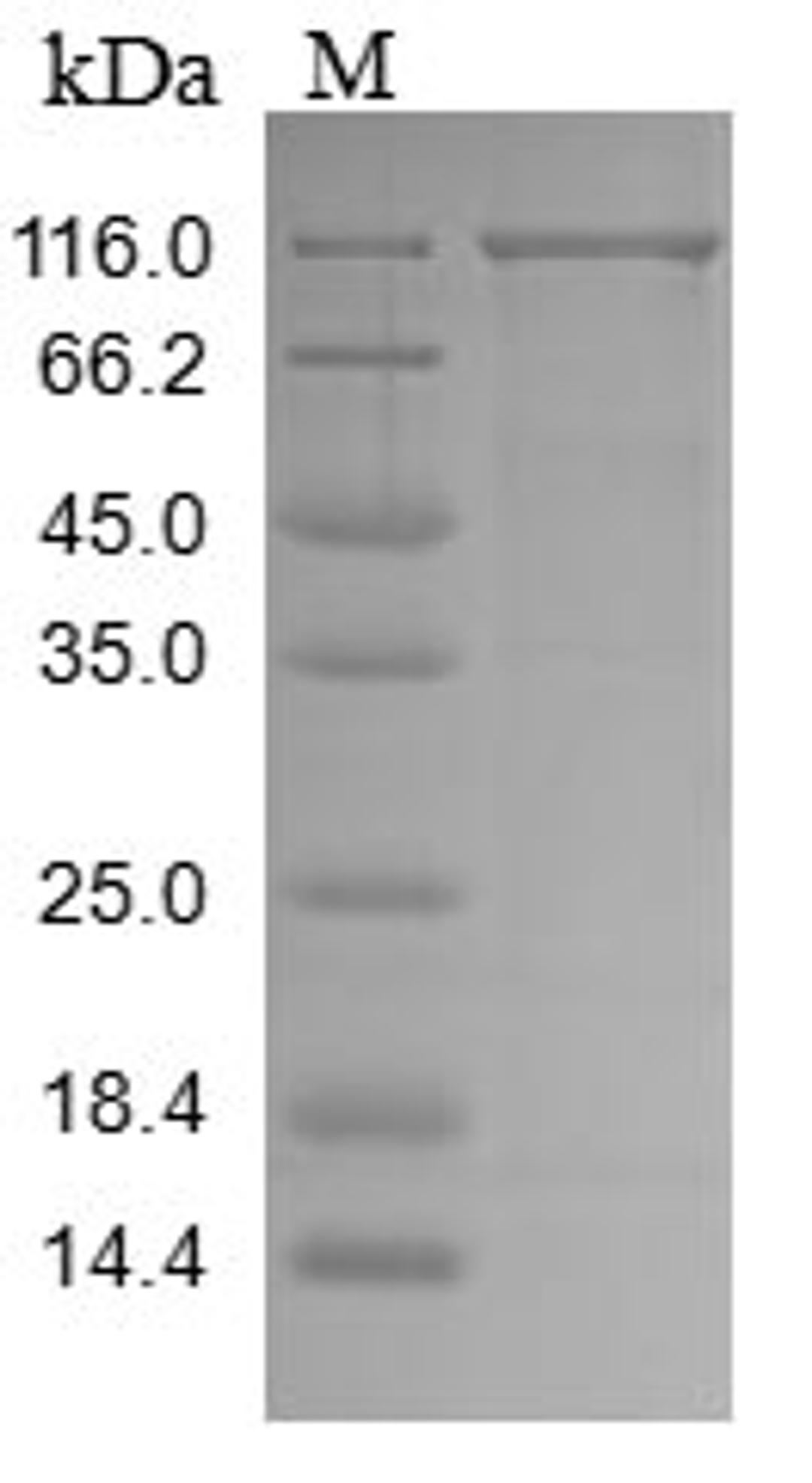 (Tris-Glycine gel) Discontinuous SDS-PAGE (reduced) with 5% enrichment gel and 15% separation gel.