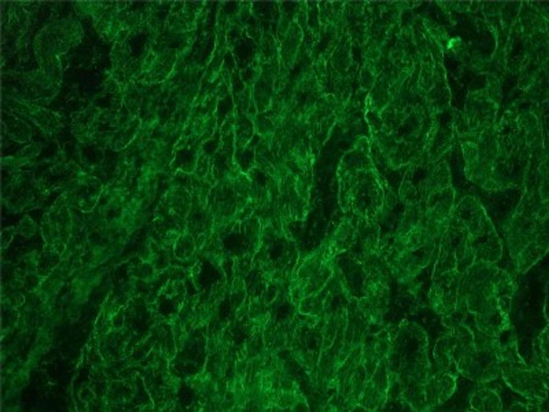 Immunocytochemistry/Immunofluorescence: Integrin beta 1D Antibody (2B1) [NBP1-97734] - Frozen sections of porcine myocardium immunostained for integrin  Beta 1D using a 1:200 dillution of 2B1