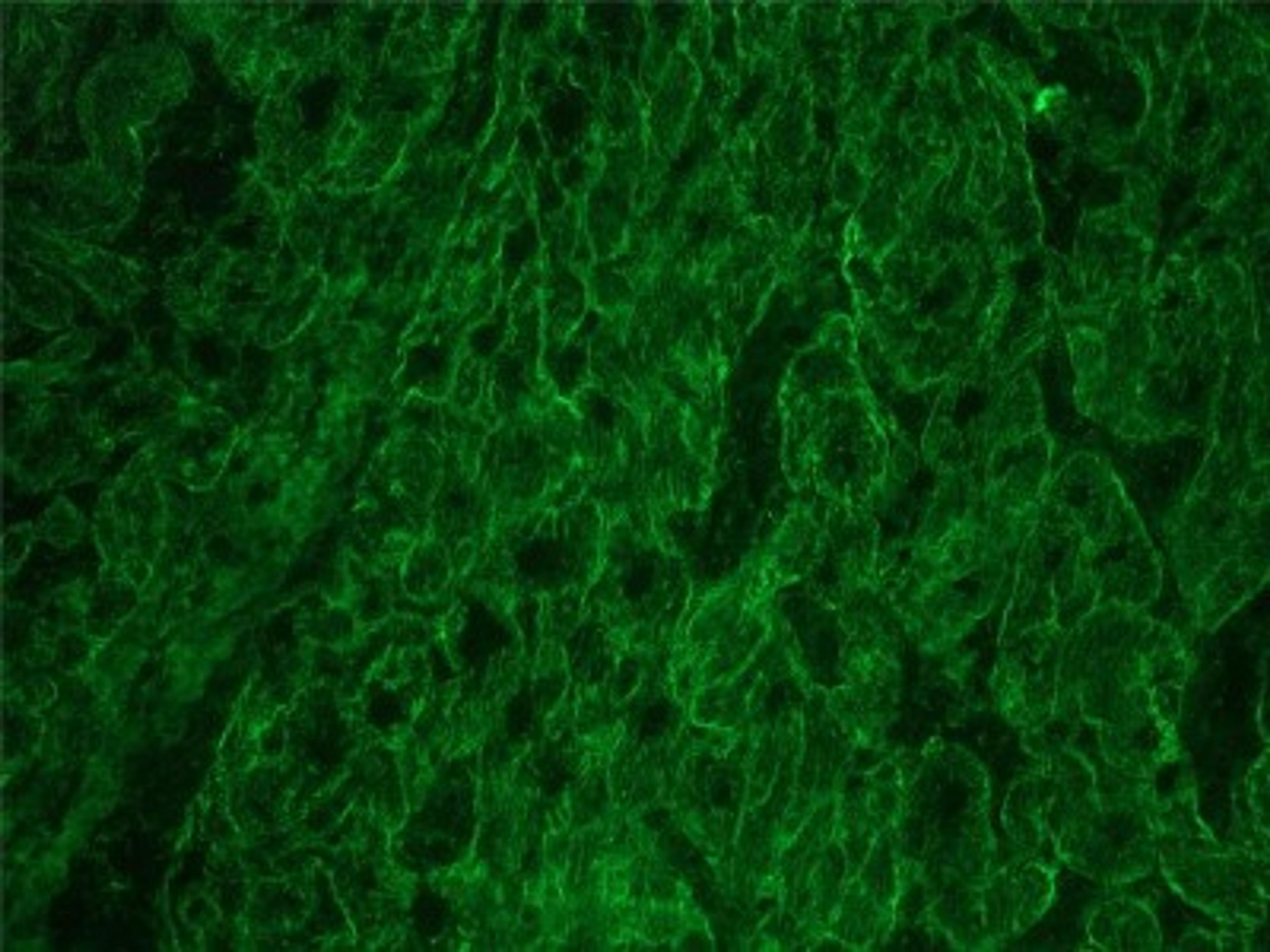 Immunocytochemistry/Immunofluorescence: Integrin beta 1D Antibody (2B1) [NBP1-97734] - Frozen sections of porcine myocardium immunostained for integrin  Beta 1D using a 1:200 dillution of 2B1