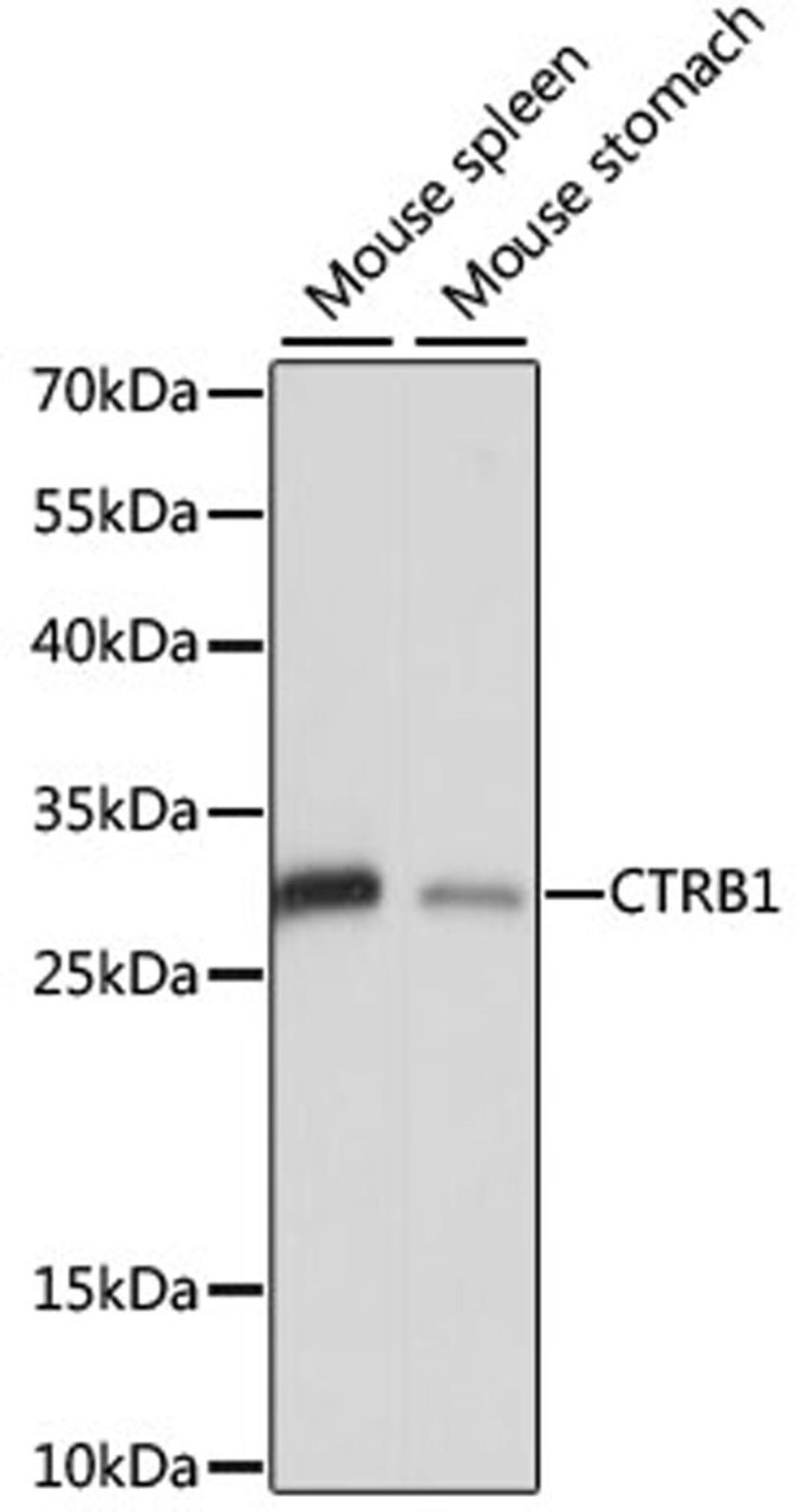 Western blot - CTRB1 antibody (A15043)