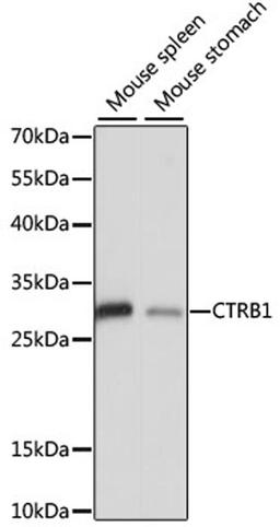 Western blot - CTRB1 antibody (A15043)