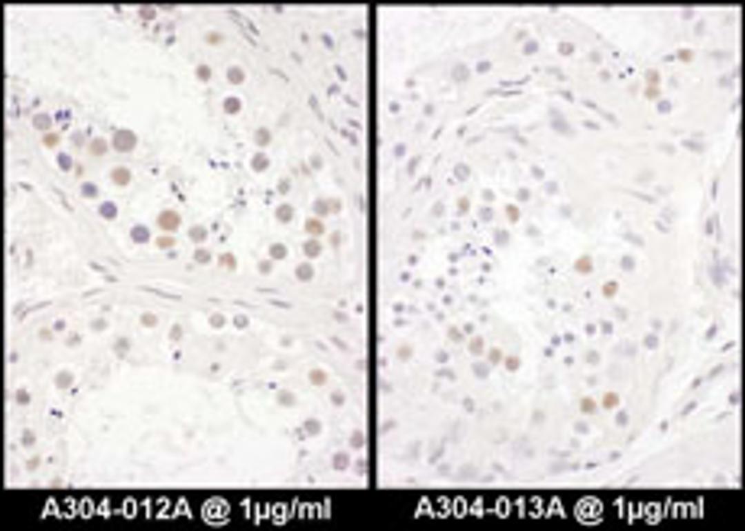 Detection of human DENTT by immunohistochemistry.