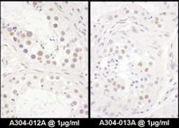 Detection of human DENTT by immunohistochemistry.