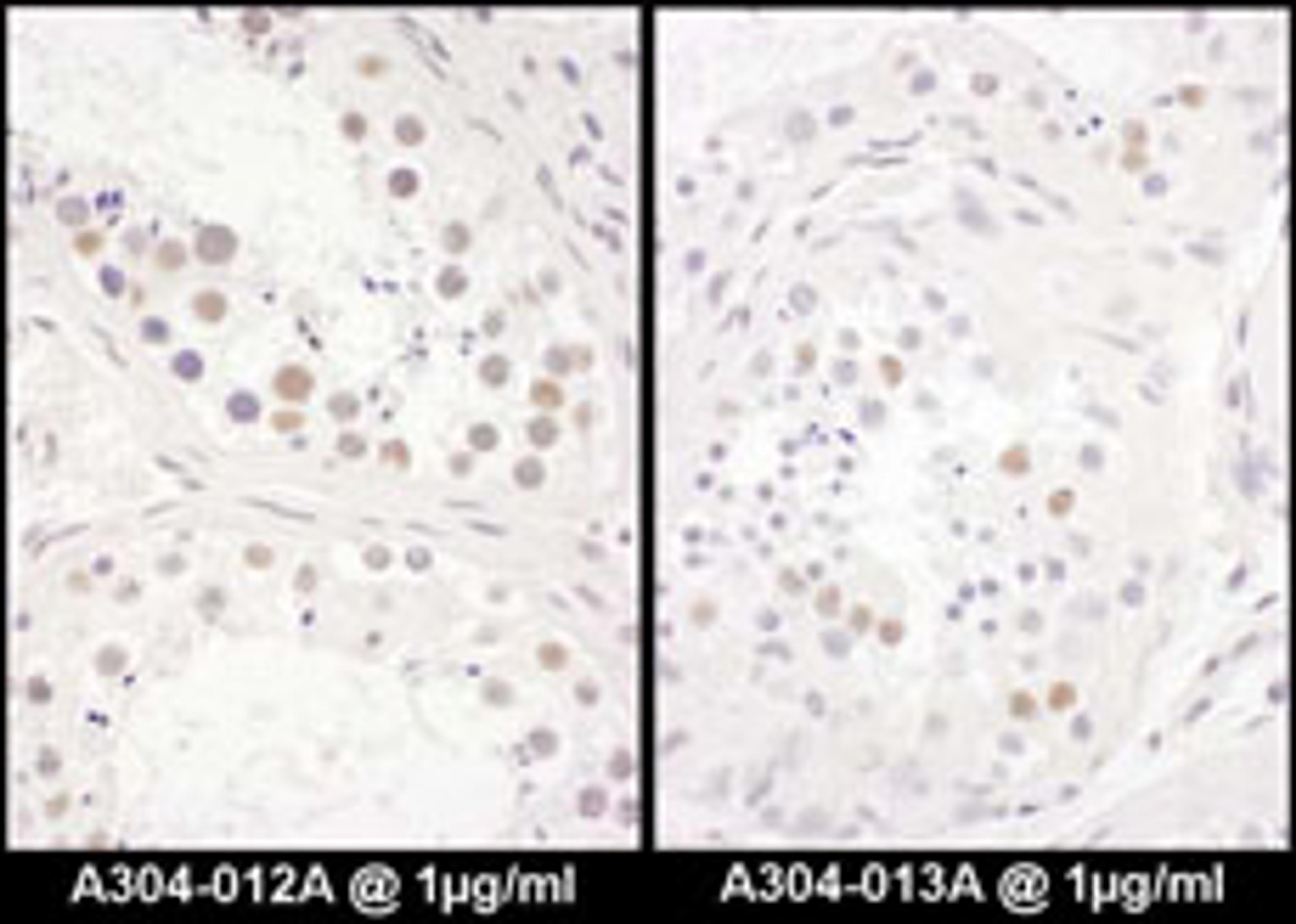 Detection of human DENTT by immunohistochemistry.