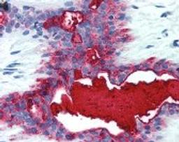 Immunohistochemistry staining of Mucin 1 in breast tissue using Mucin 1 monoclonal Antibody.