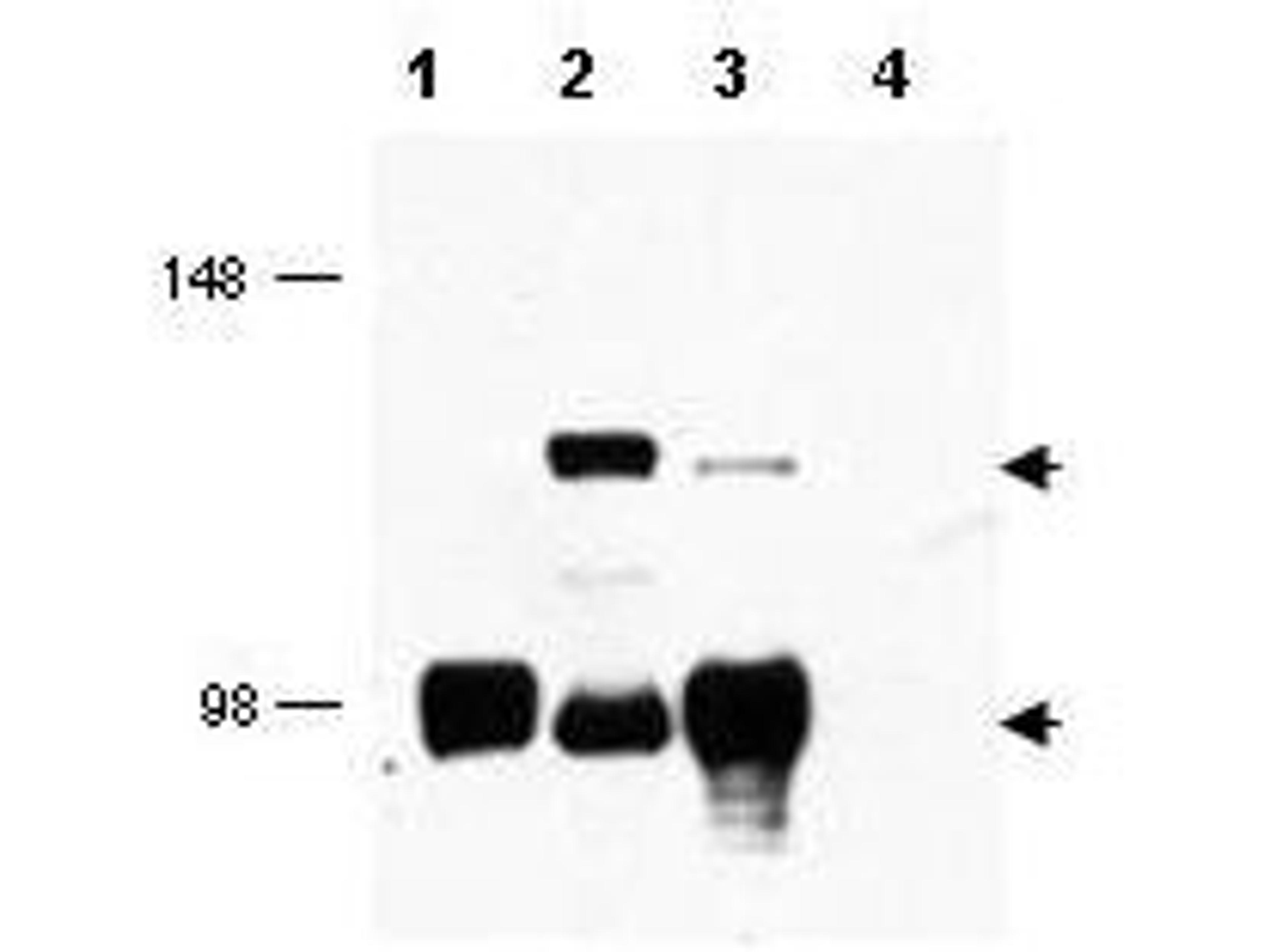 Western blot analysis of Lane 1 contains lysate from cells expressing MECT2 only. Lane 2 contains lysate from cells using MECT1 antibody