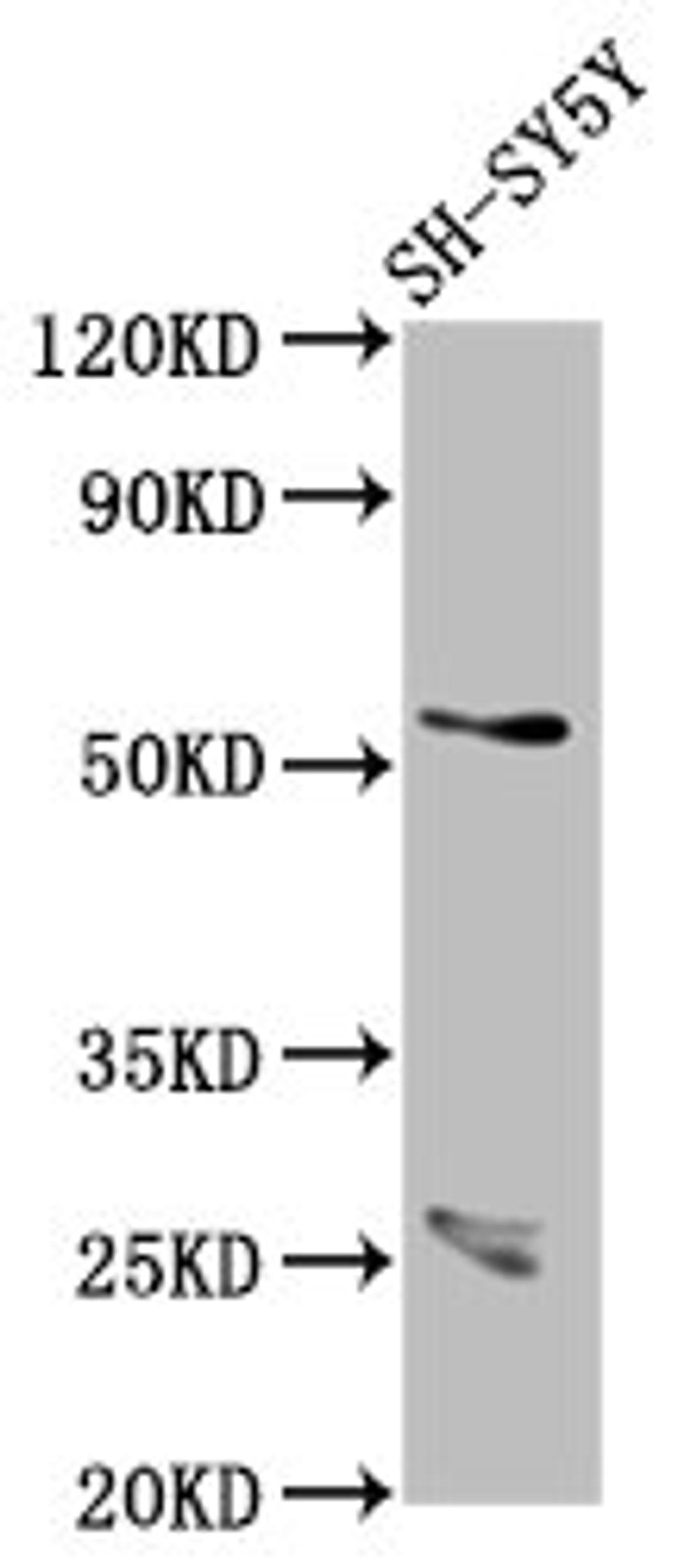 Western Blot. Positive WB detected in: SH-SY5Y whole cell lysate. All lanes: CDR2L antibody at 7.1ug/ml. Secondary. Goat polyclonal to rabbit IgG at 1/50000 dilution. Predicted band size: 54 kDa. Observed band size: 54 kDa.