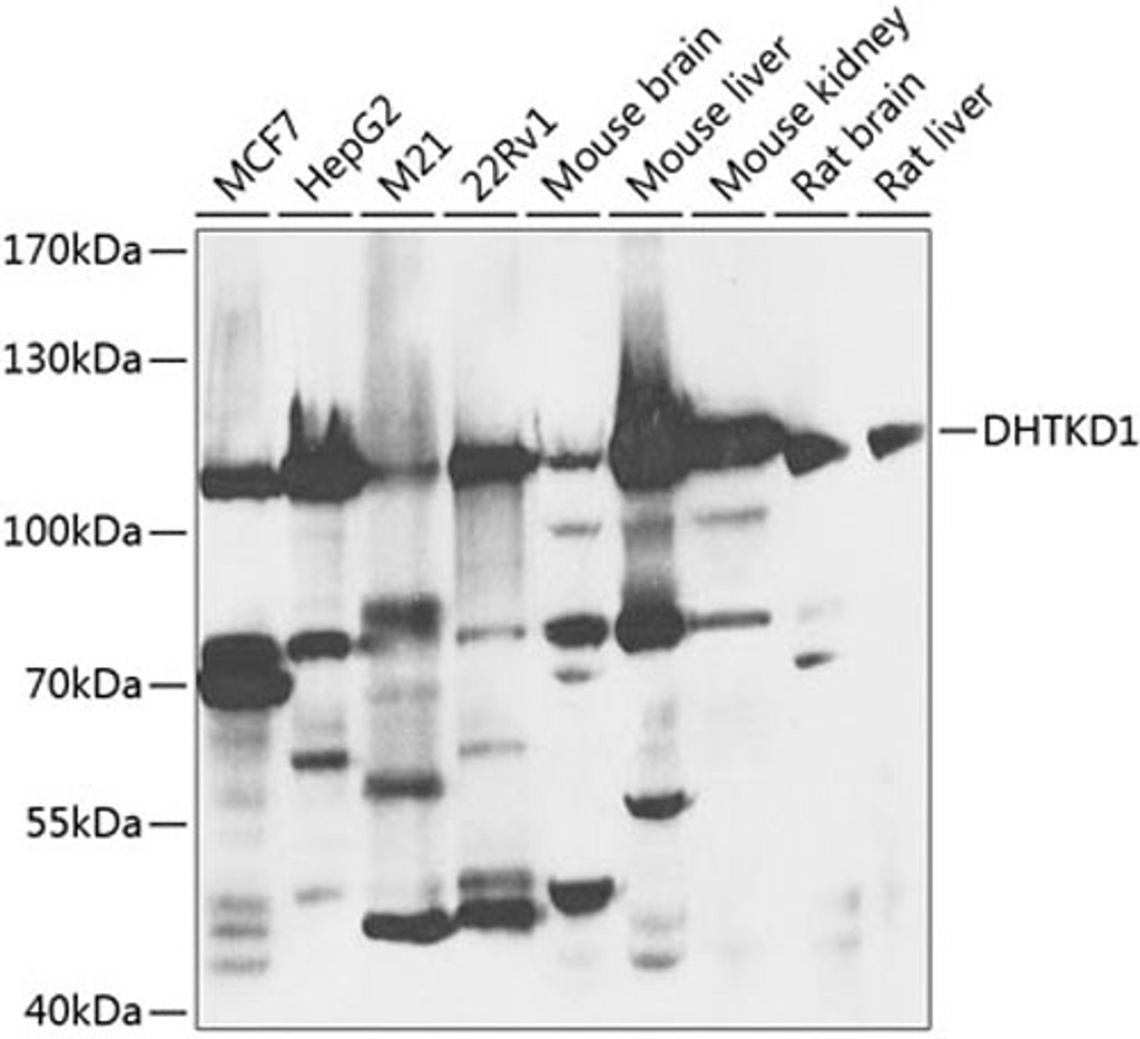 Western blot - DHTKD1 antibody (A8369)