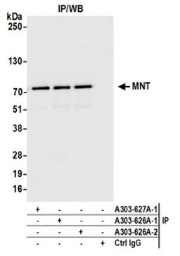 Detection of human MNT by western blot of immunoprecipitates.