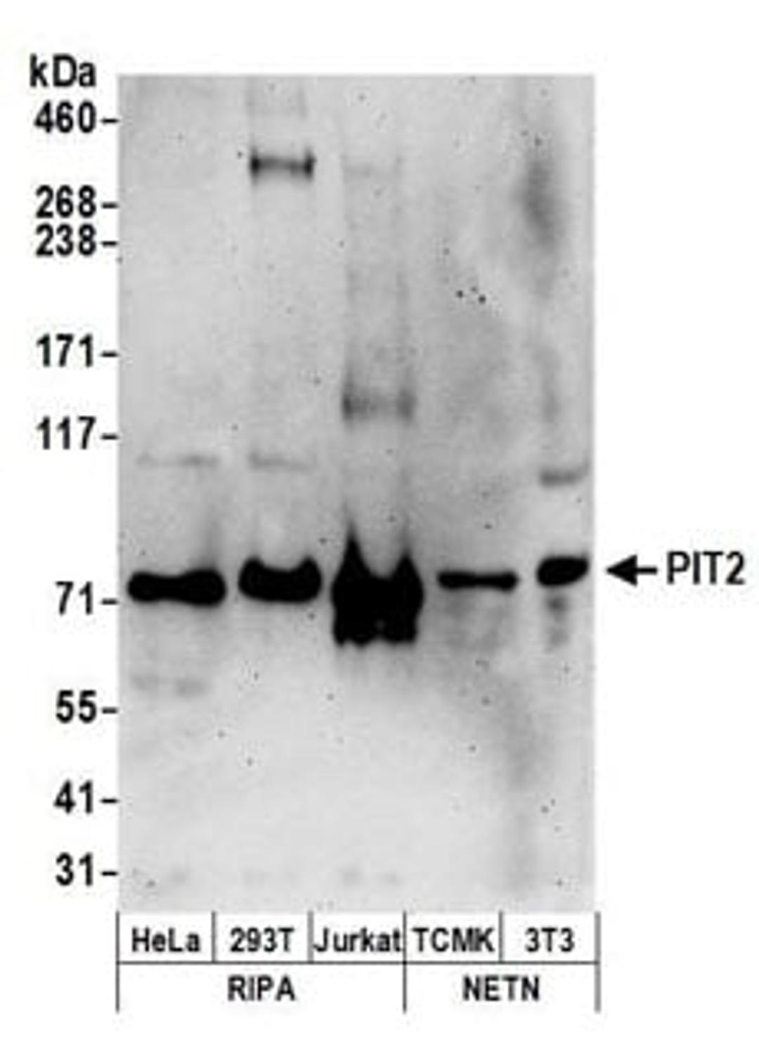 Detection of human and mouse PIT2 by western blot.