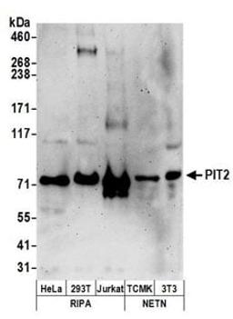 Detection of human and mouse PIT2 by western blot.