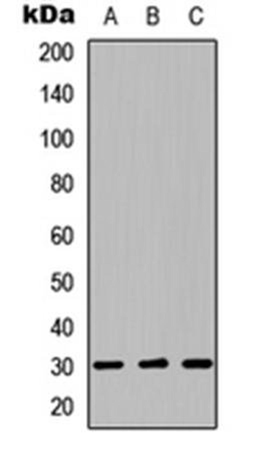 Western blot analysis of HEK293T (Lane1), Raw264.7 (Lane2), H9C2 (Lane3) whole cell using LYL1 antibody