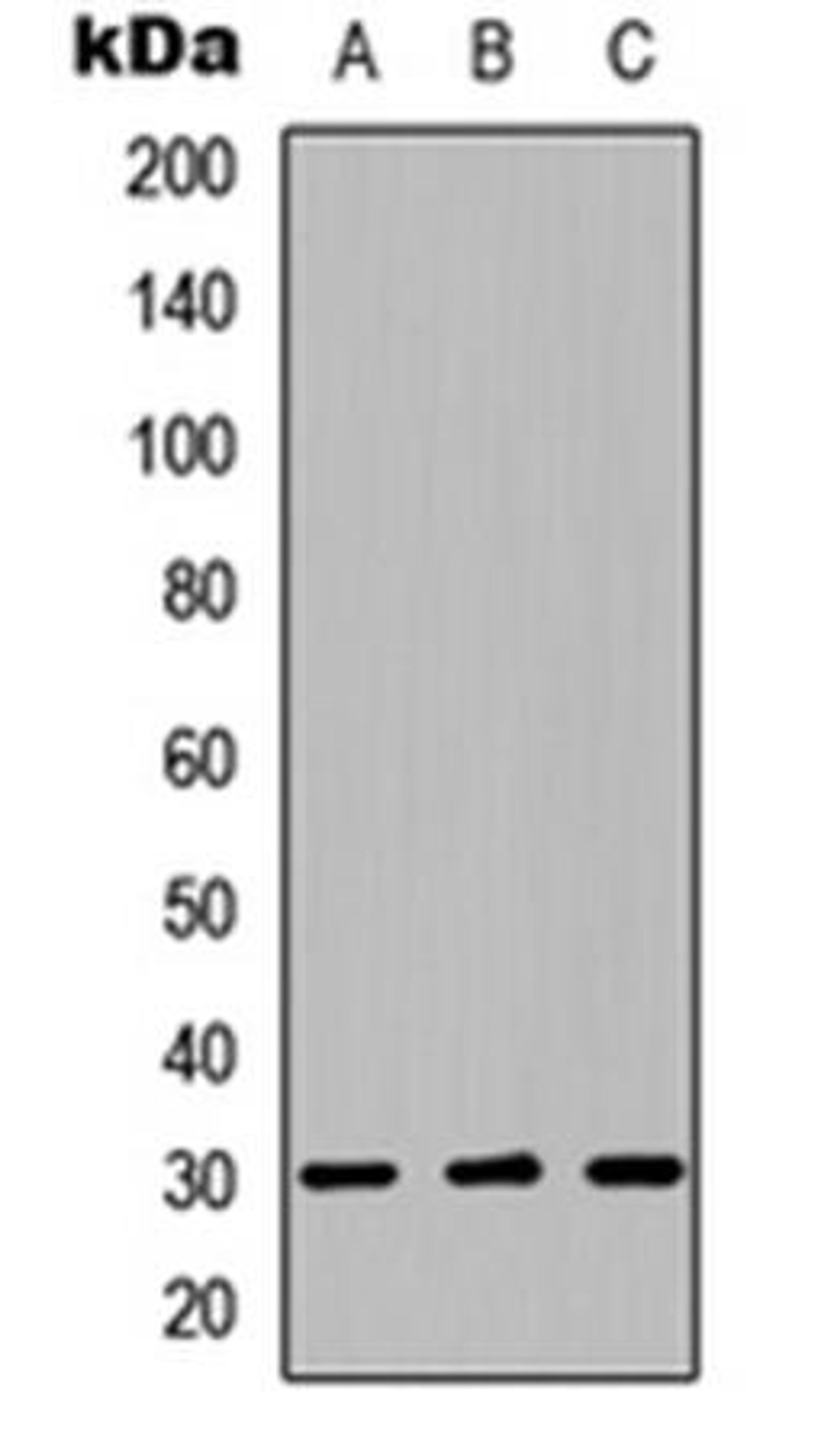 Western blot analysis of HEK293T (Lane1), Raw264.7 (Lane2), H9C2 (Lane3) whole cell using LYL1 antibody