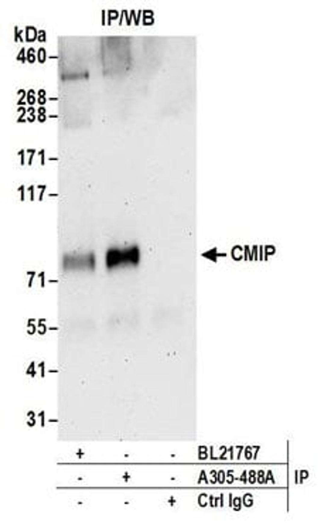 Detection of human CMIP by western blot of immunoprecipitates.