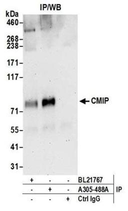 Detection of human CMIP by western blot of immunoprecipitates.