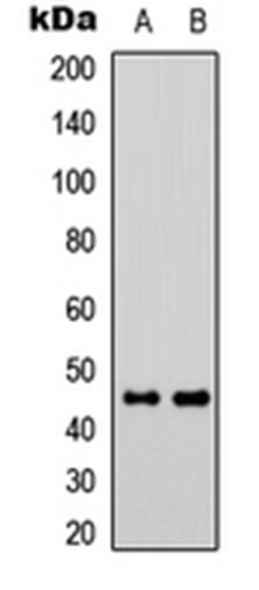 Western blot analysis of Jurkat (Lane 1), Raw264.7 (Lane 2) whole cell lysates using GPR73a antibody