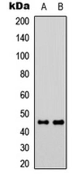 Western blot analysis of Jurkat (Lane 1), Raw264.7 (Lane 2) whole cell lysates using GPR73a antibody