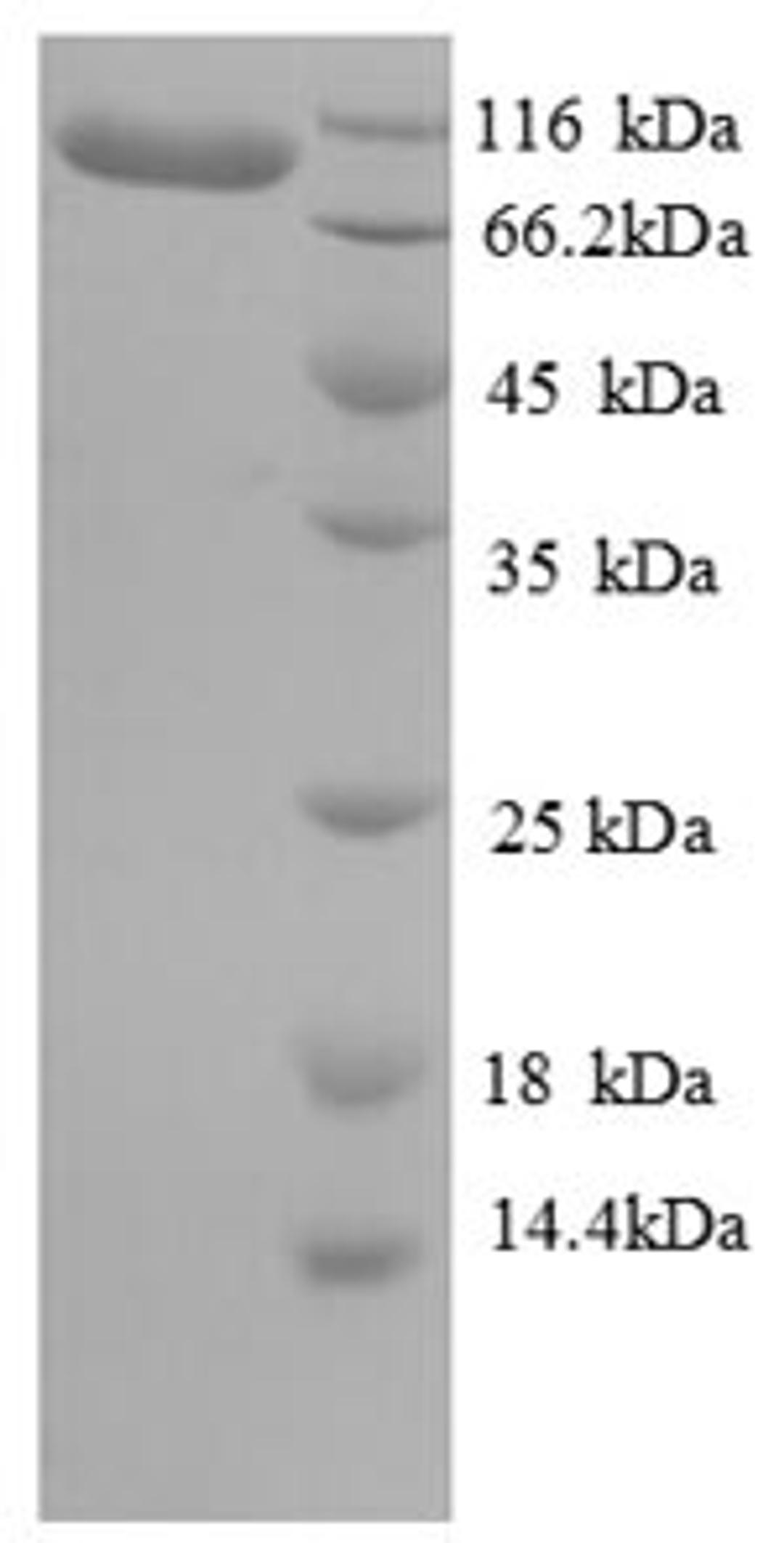(Tris-Glycine gel) Discontinuous SDS-PAGE (reduced) with 5% enrichment gel and 15% separation gel.