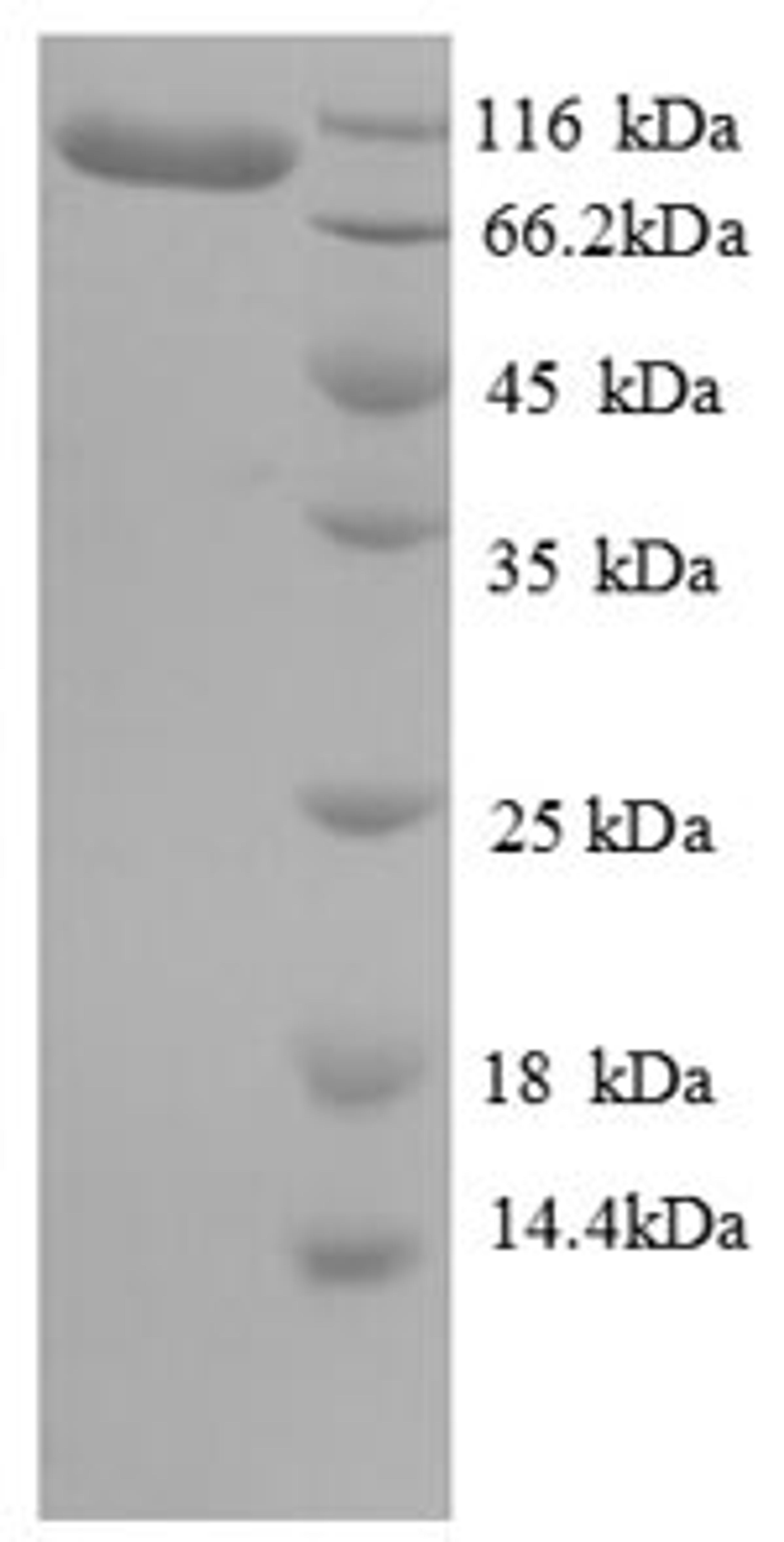 (Tris-Glycine gel) Discontinuous SDS-PAGE (reduced) with 5% enrichment gel and 15% separation gel.