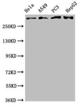 Western Blot. Positive WB detected in: Hela whole cell lysate, A549 whole cell lysate, PC3 whole cell lysate, HepG2 whole cell lysate. All lanes: ATM antibody at 2.05μg/ml. Secondary. Goat polyclonal to rabbit IgG at 1/50000 dilution. Predicted band size: 350 KDa. Observed band size: 350 KDa.