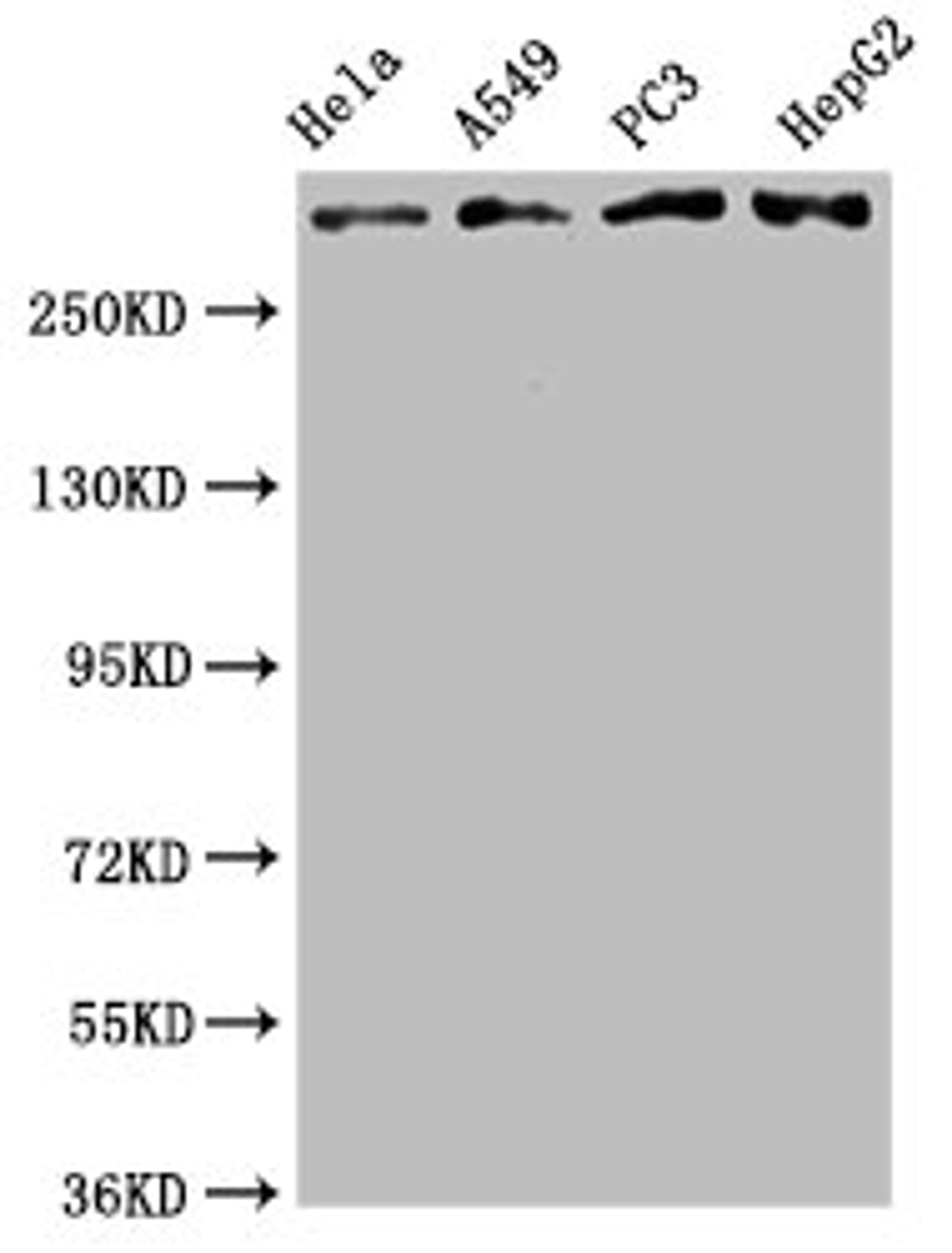 Western Blot. Positive WB detected in: Hela whole cell lysate, A549 whole cell lysate, PC3 whole cell lysate, HepG2 whole cell lysate. All lanes: ATM antibody at 2.05μg/ml. Secondary. Goat polyclonal to rabbit IgG at 1/50000 dilution. Predicted band size: 350 KDa. Observed band size: 350 KDa.