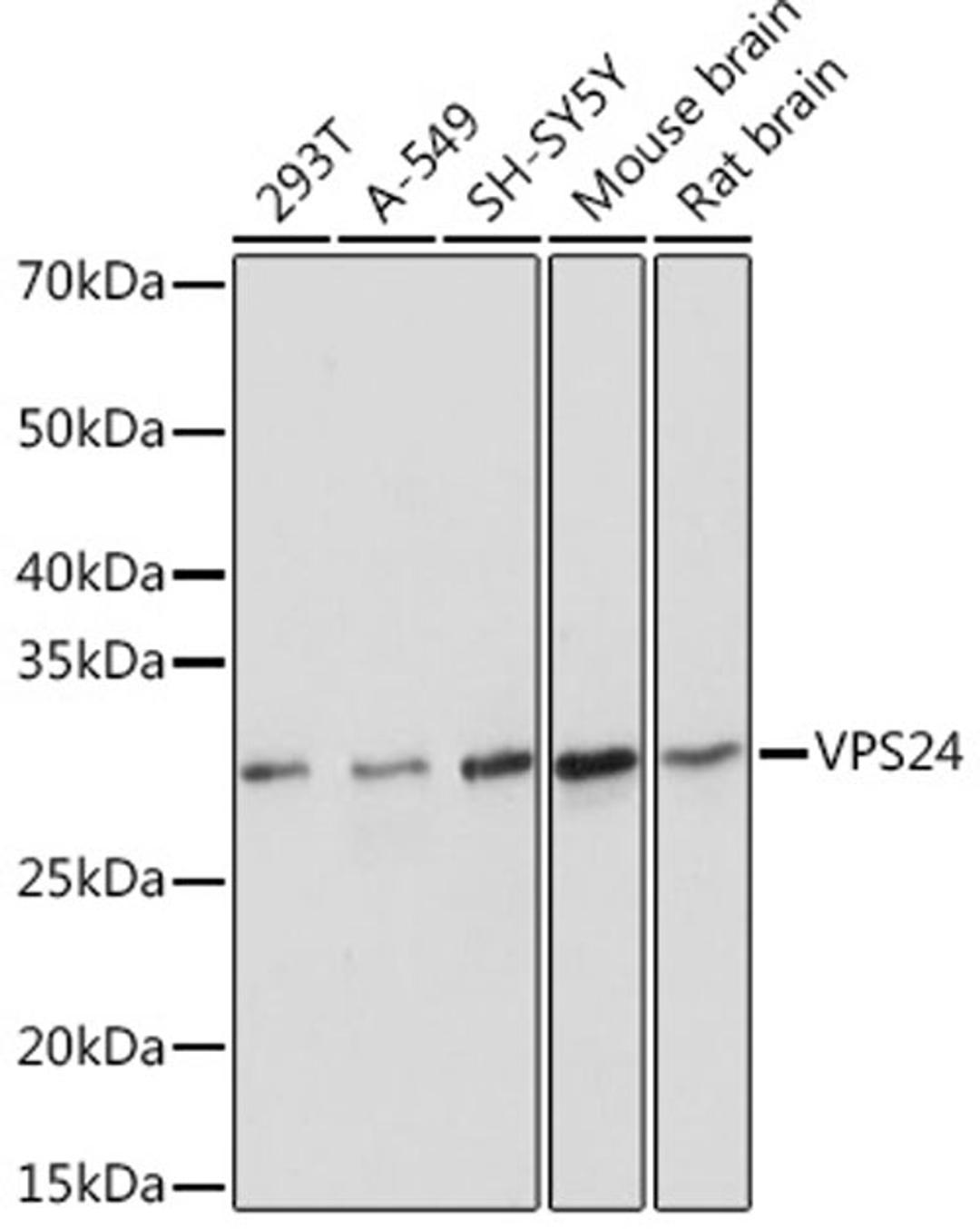 Western blot - VPS24 Rabbit mAb (A0941)