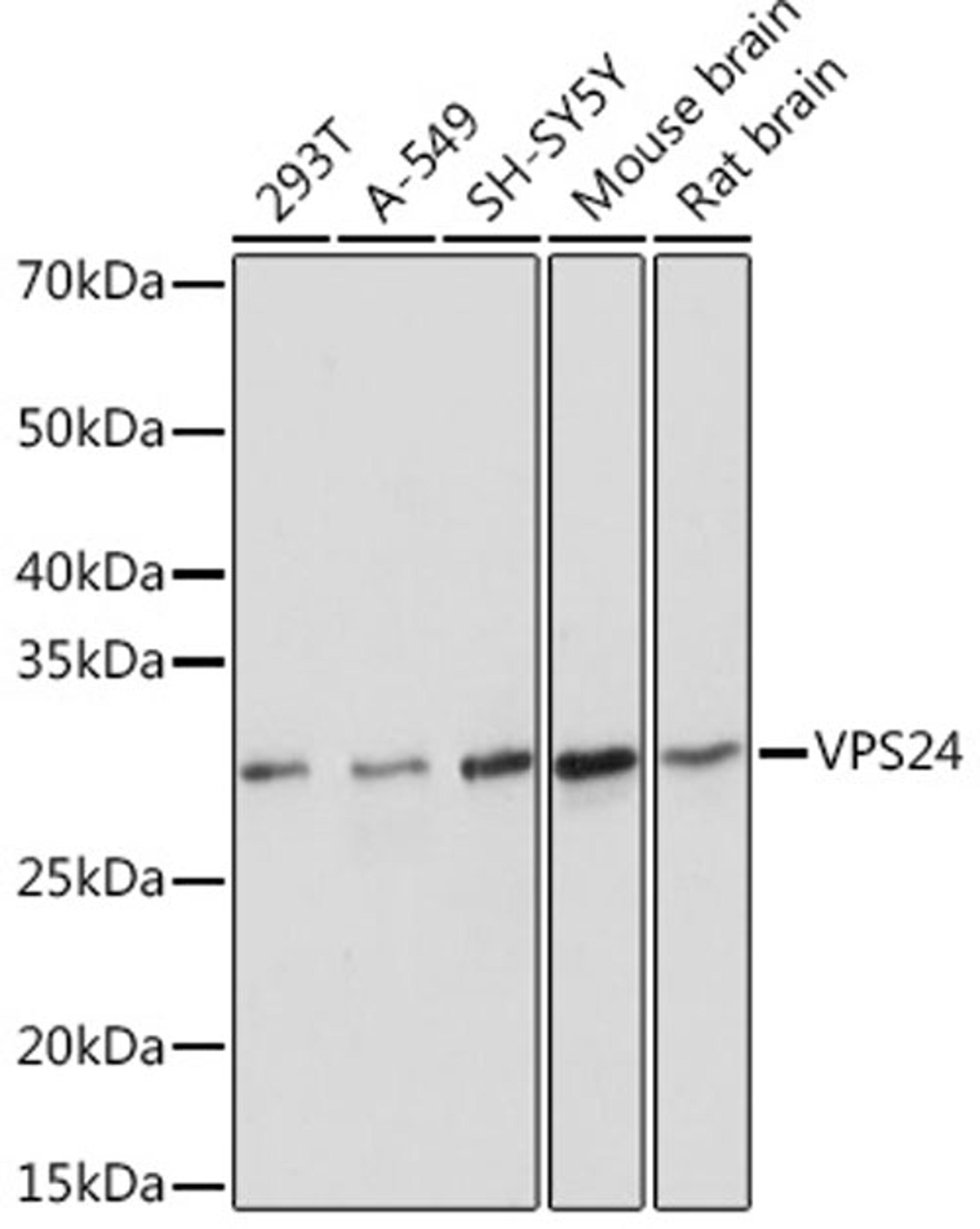 Western blot - VPS24 Rabbit mAb (A0941)