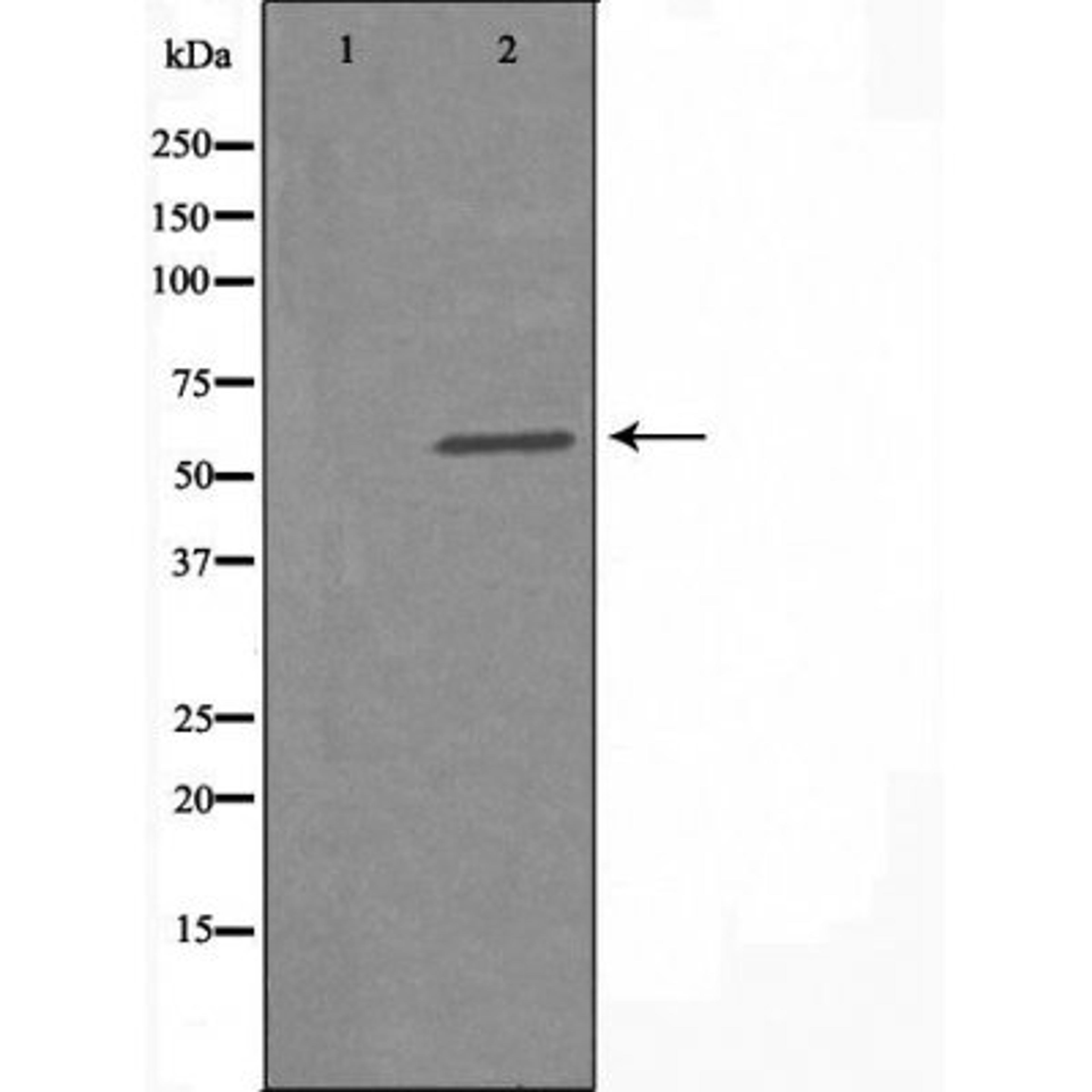 Western blot analysis of HUVEC cells using WEE2 antibody