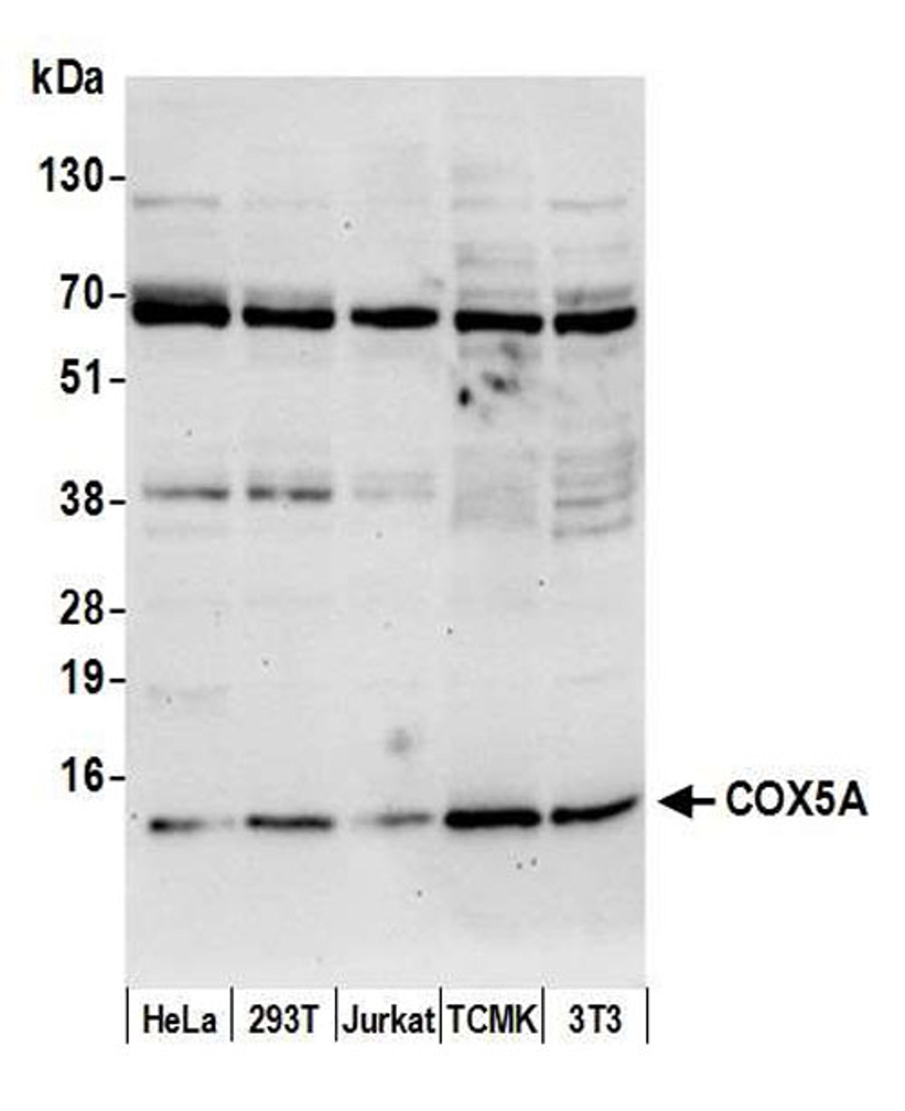 Detection of human and mouse COX5A by WB.