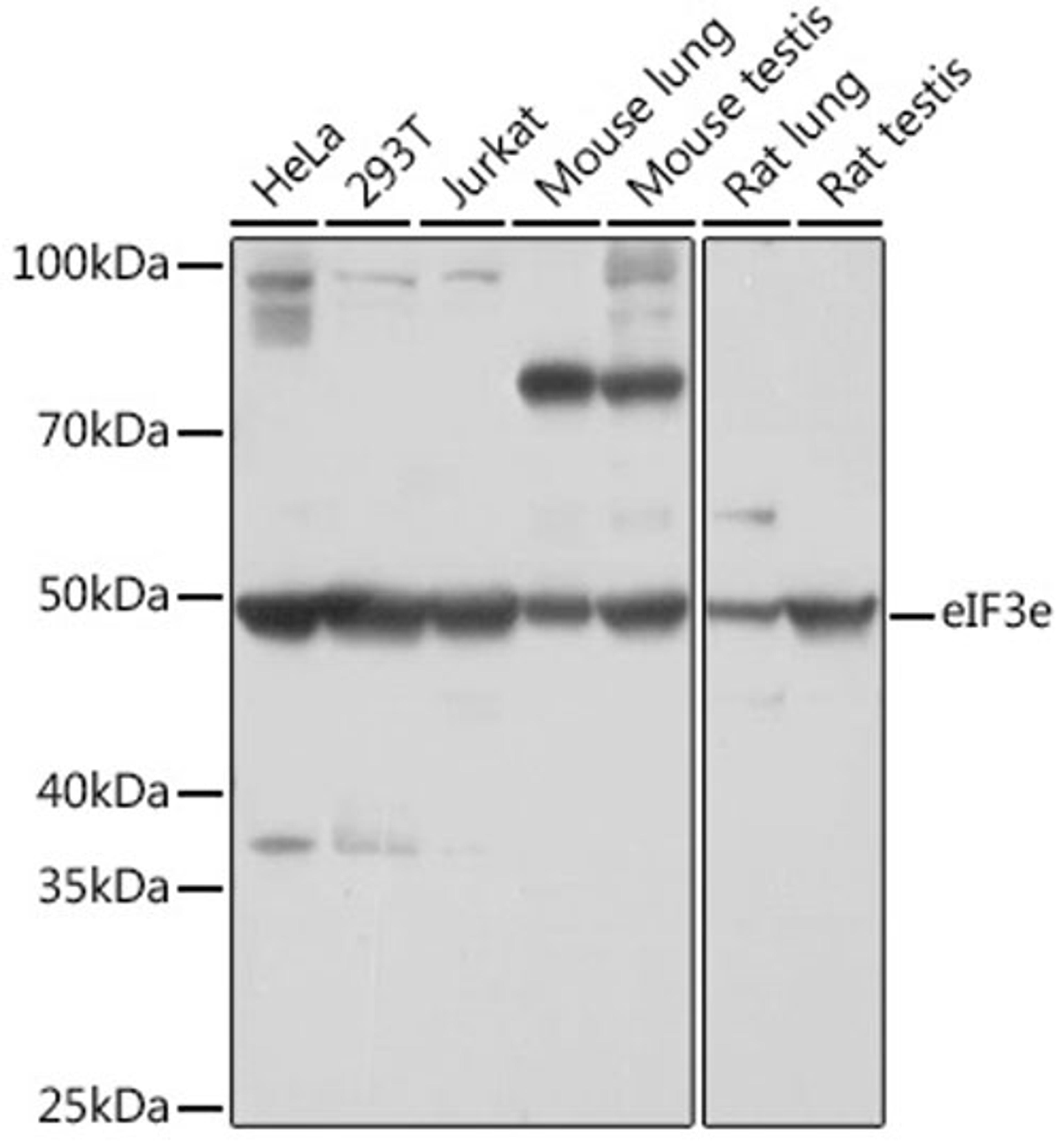 Western blot - eIF3e Rabbit mAb (A3431)