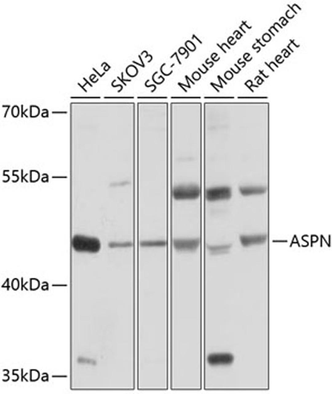 Western blot - ASPN antibody (A10311)