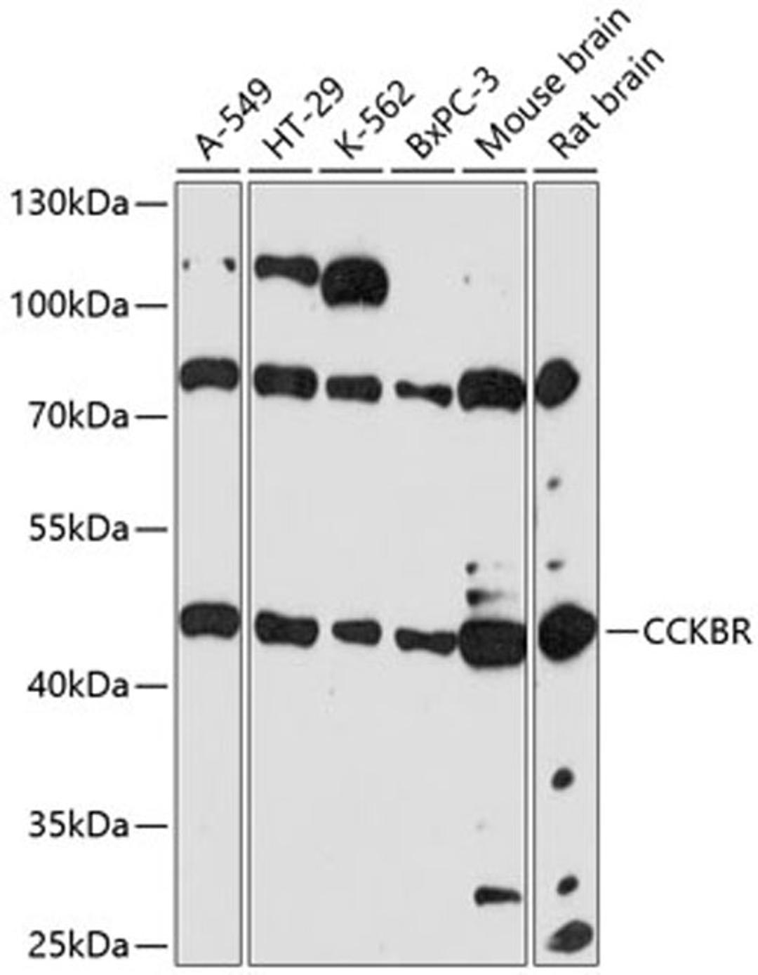 Western blot - CCKBR antibody (A14567)