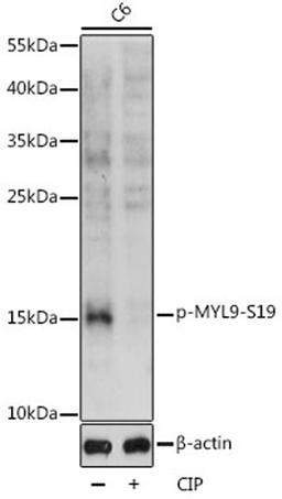 Western blot - Phospho-MYL9-S19 antibody (AP0872)