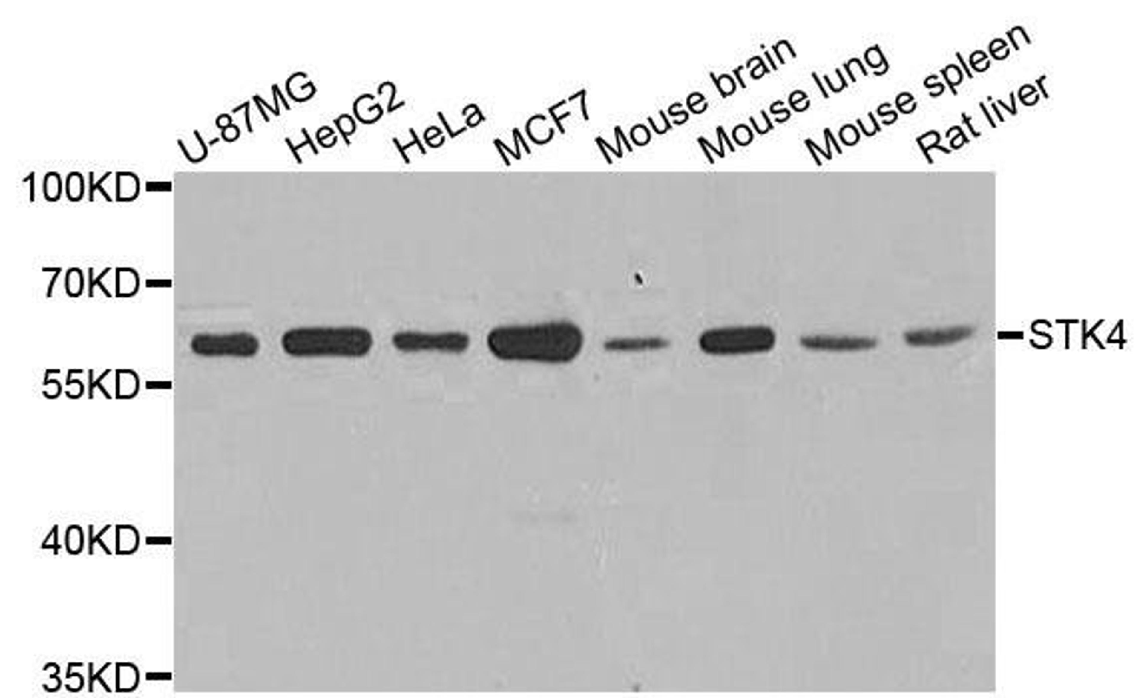 Western blot analysis of extracts of various cell lines using STK4 antibody