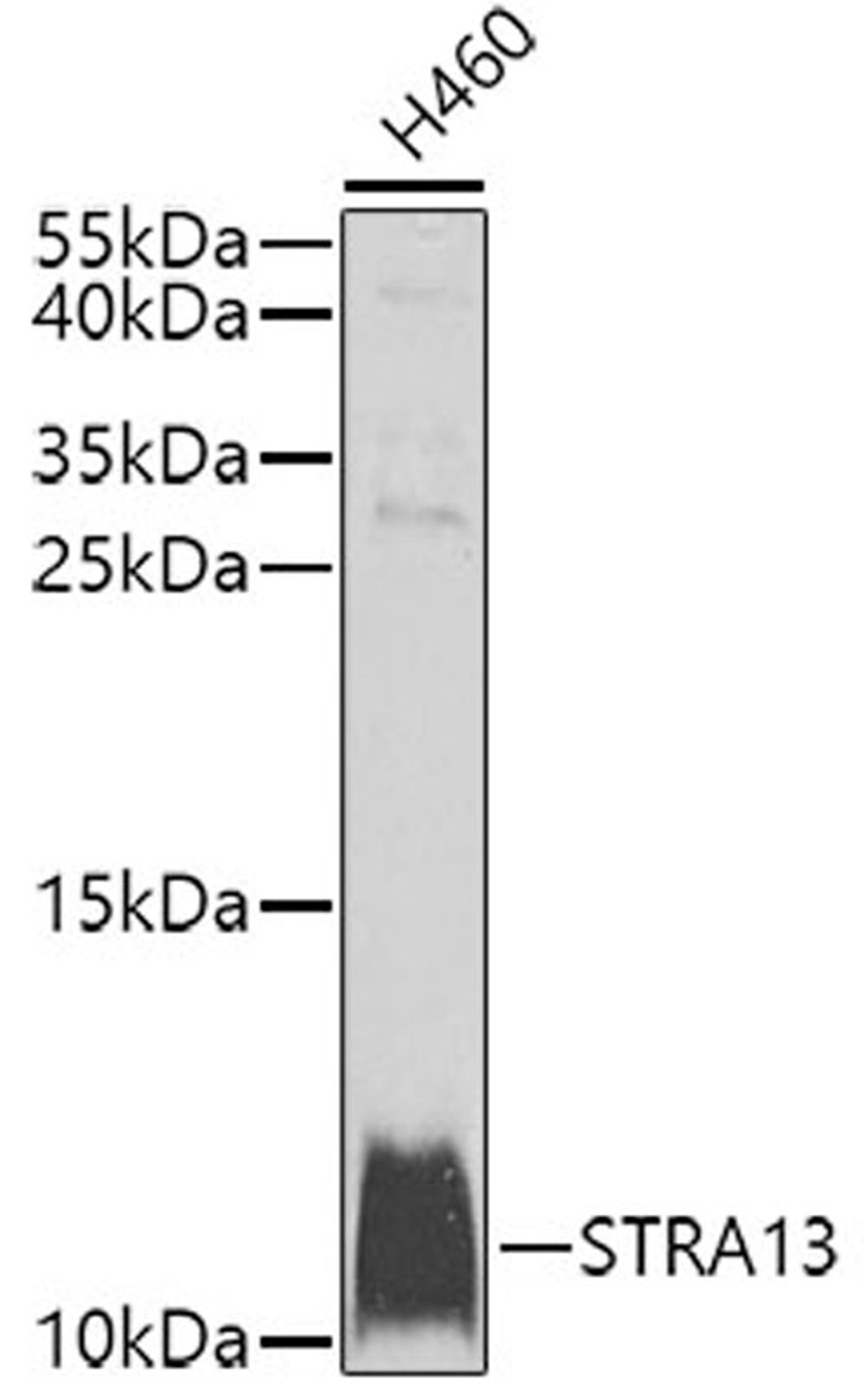 Western blot - STRA13 antibody (A9892)