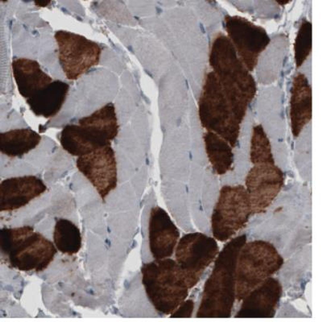 Immunohistochemistry: MYH6 Antibody (CL2162) [NBP2-36746] - Staining of human skeletal muscle shows strong cytoplasmic immunoreactivity in a subset of striated muscle fibers.