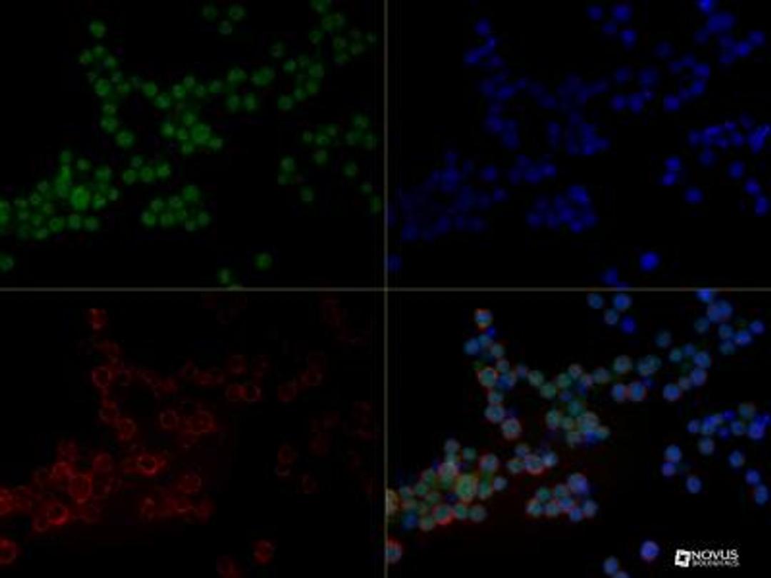 Immunocytochemistry/Immunofluorescence: NGFI-B alpha/Nur77/NR4A1 Antibody [NB100-56745] - NUR77 antibody was tested in Jurkat cells at a 1:50 dilution against Dylight 488 (Green). Alpha tubulin and nuclei were counterstained against Dylight 568 (Red) and DAPI (Blue), respectively.