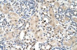 Antibody used in IHC on Human kidney.