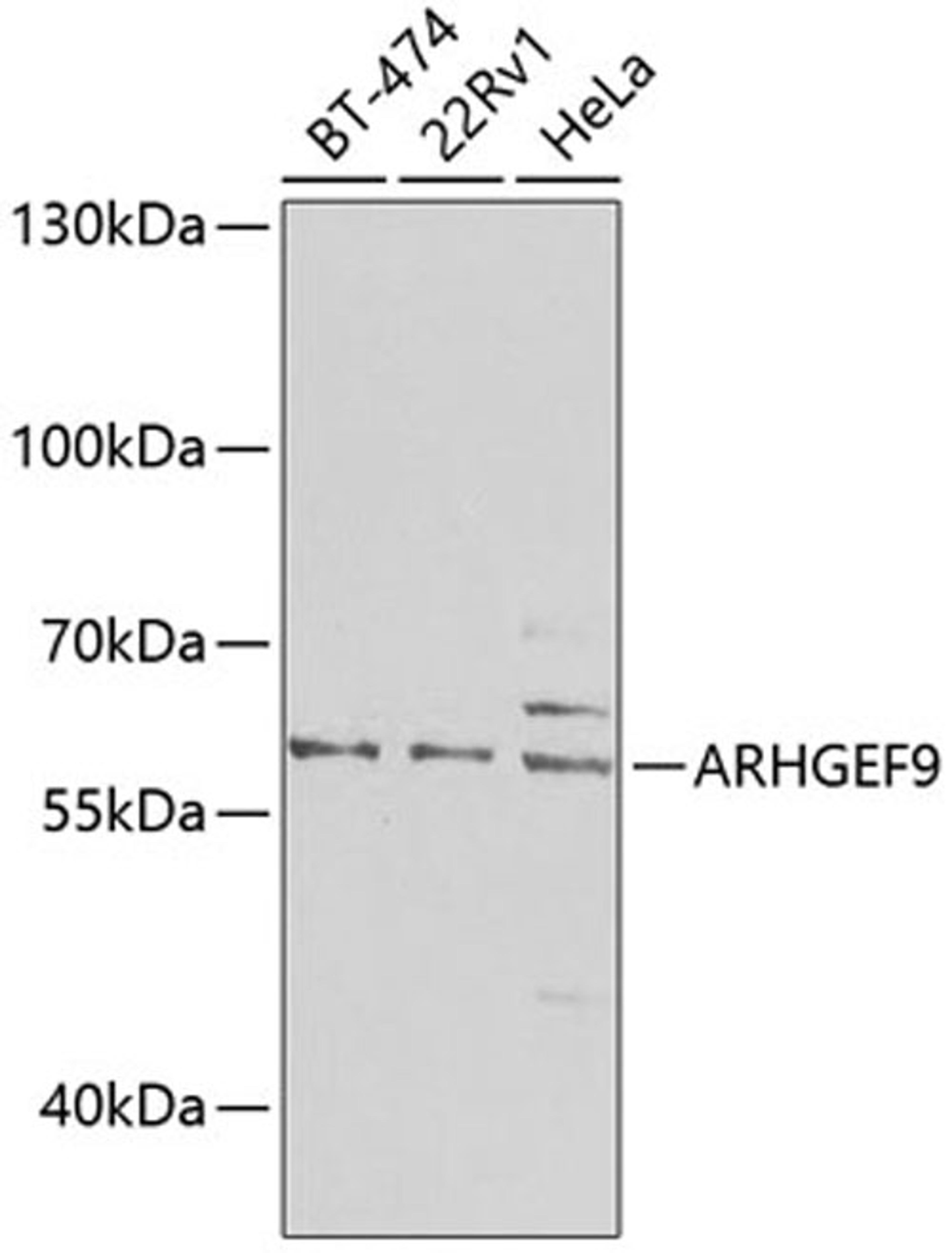 Western blot - ARHGEF9 antibody (A7964)