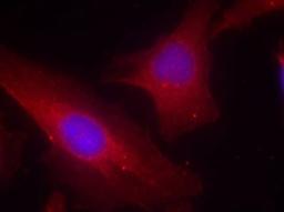 Immunocytochemistry/Immunofluorescence: DOK2 Antibody [NB100-82108] - Staining of methanol-fixed Hela cells using p56Dok-2 (Ab-299) antibody