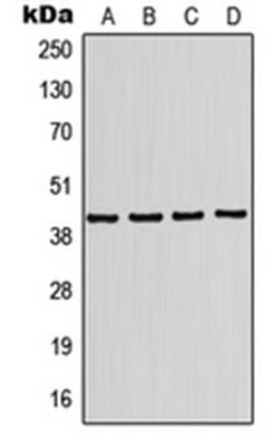 Western blot analysis of HL60 (Lane 1), Jurkat (Lane 2), mouse brain (Lane 3), rat brain (Lane 4) whole cell lysates using KCNJ10 antibody