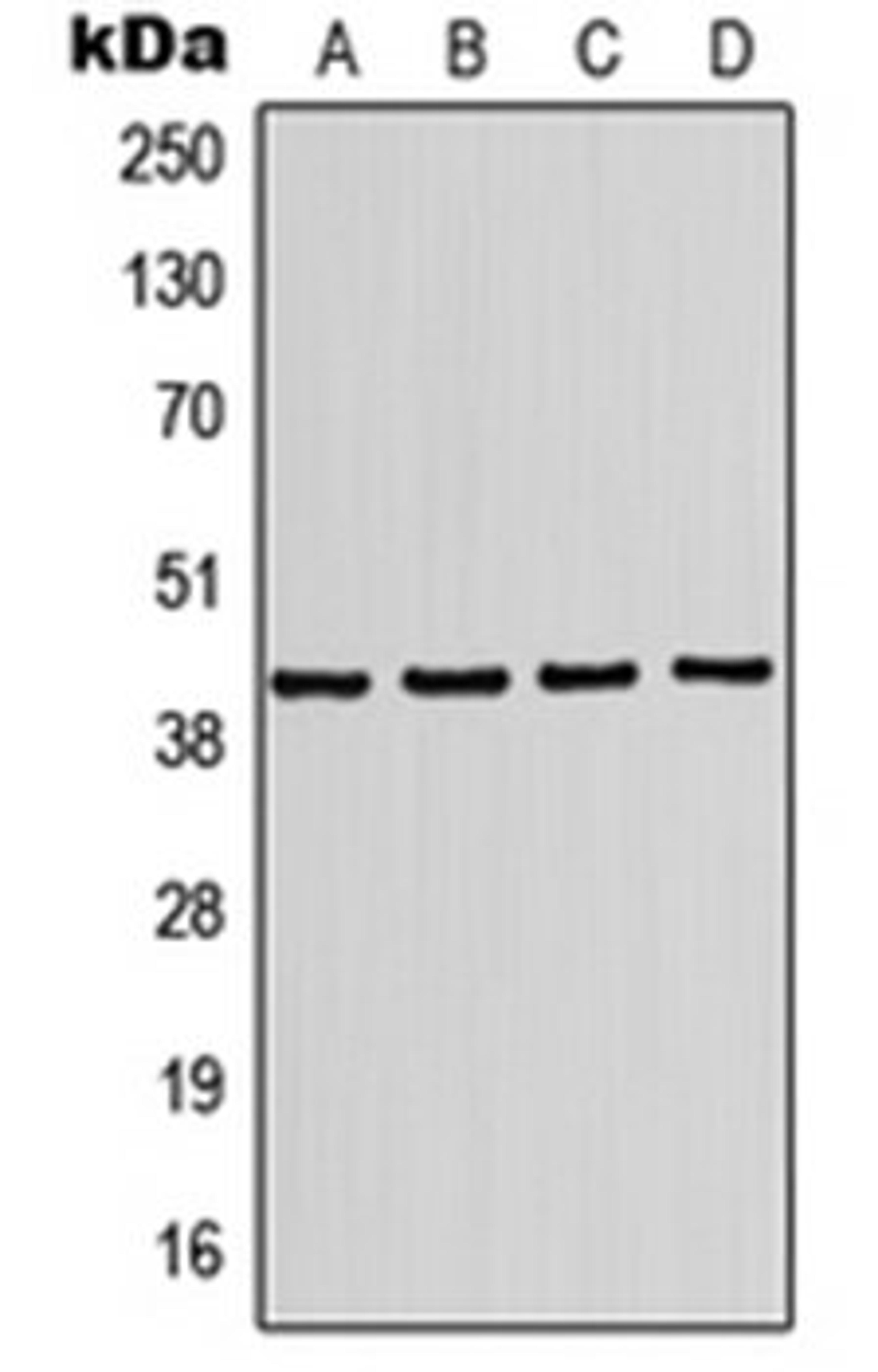 Western blot analysis of HL60 (Lane 1), Jurkat (Lane 2), mouse brain (Lane 3), rat brain (Lane 4) whole cell lysates using KCNJ10 antibody