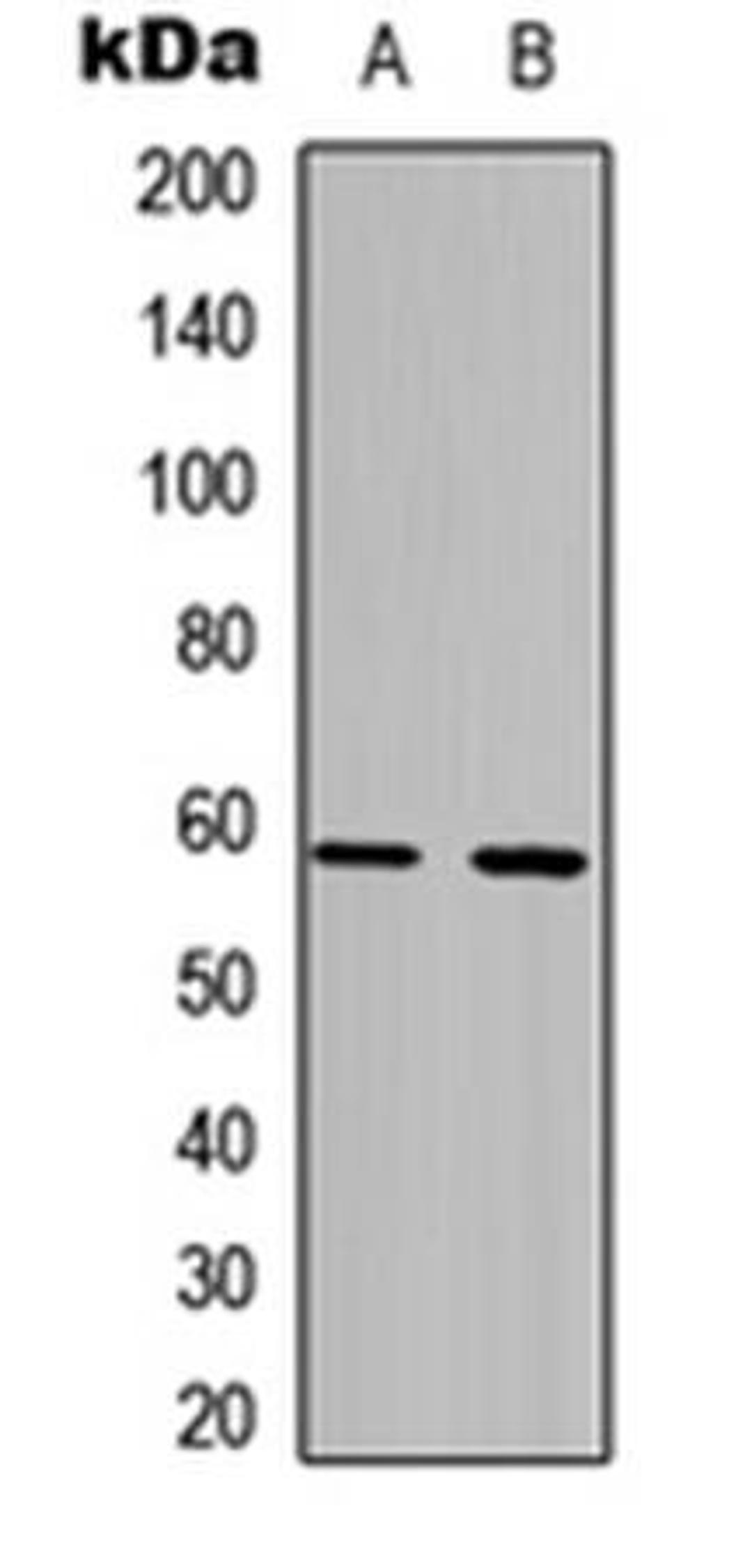 Western blot analysis of HCT116 (Lane1), NIH3T3 (Lane2) whole cell using PFKFB2 antibody