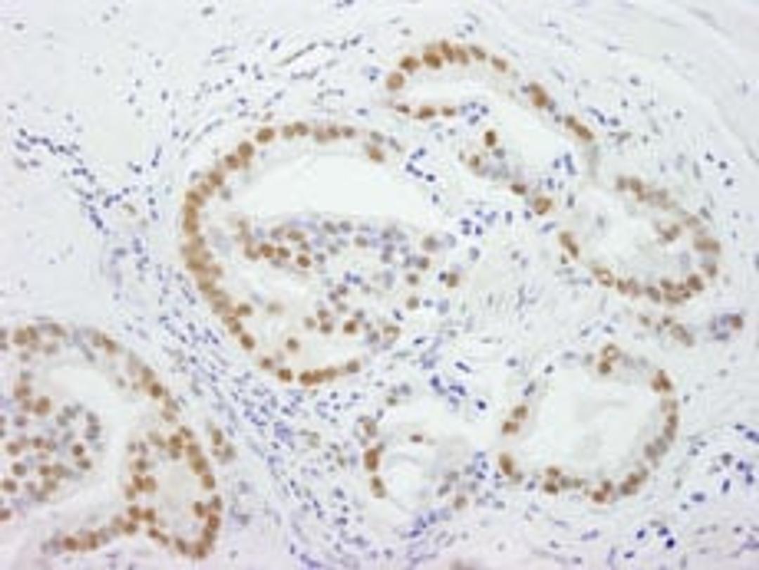 Detection of human DDX5 by immunohistochemistry.