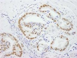 Detection of human DDX5 by immunohistochemistry.