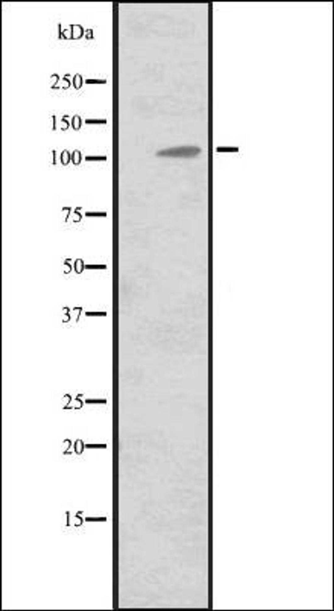 Western blot analysis of Hela cell lysate using MIB2 antibody