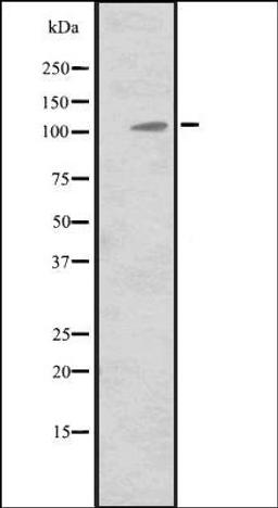 Western blot analysis of Hela cell lysate using MIB2 antibody