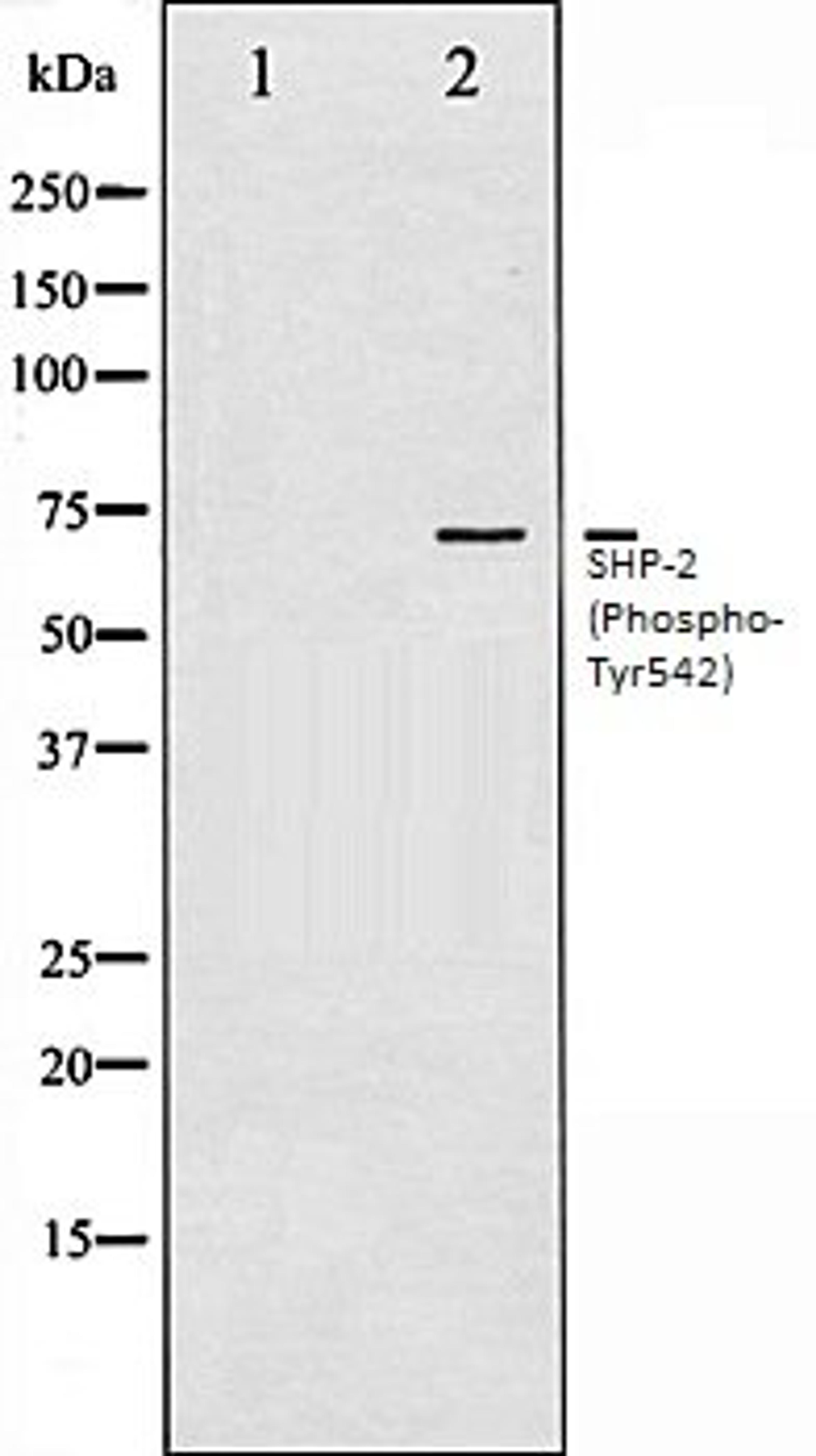 Western blot analysis of A431 whole cell lysates using SHP-2 (Phospho-Tyr542) antibody, The lane on the left is treated with the antigen-specific peptide.