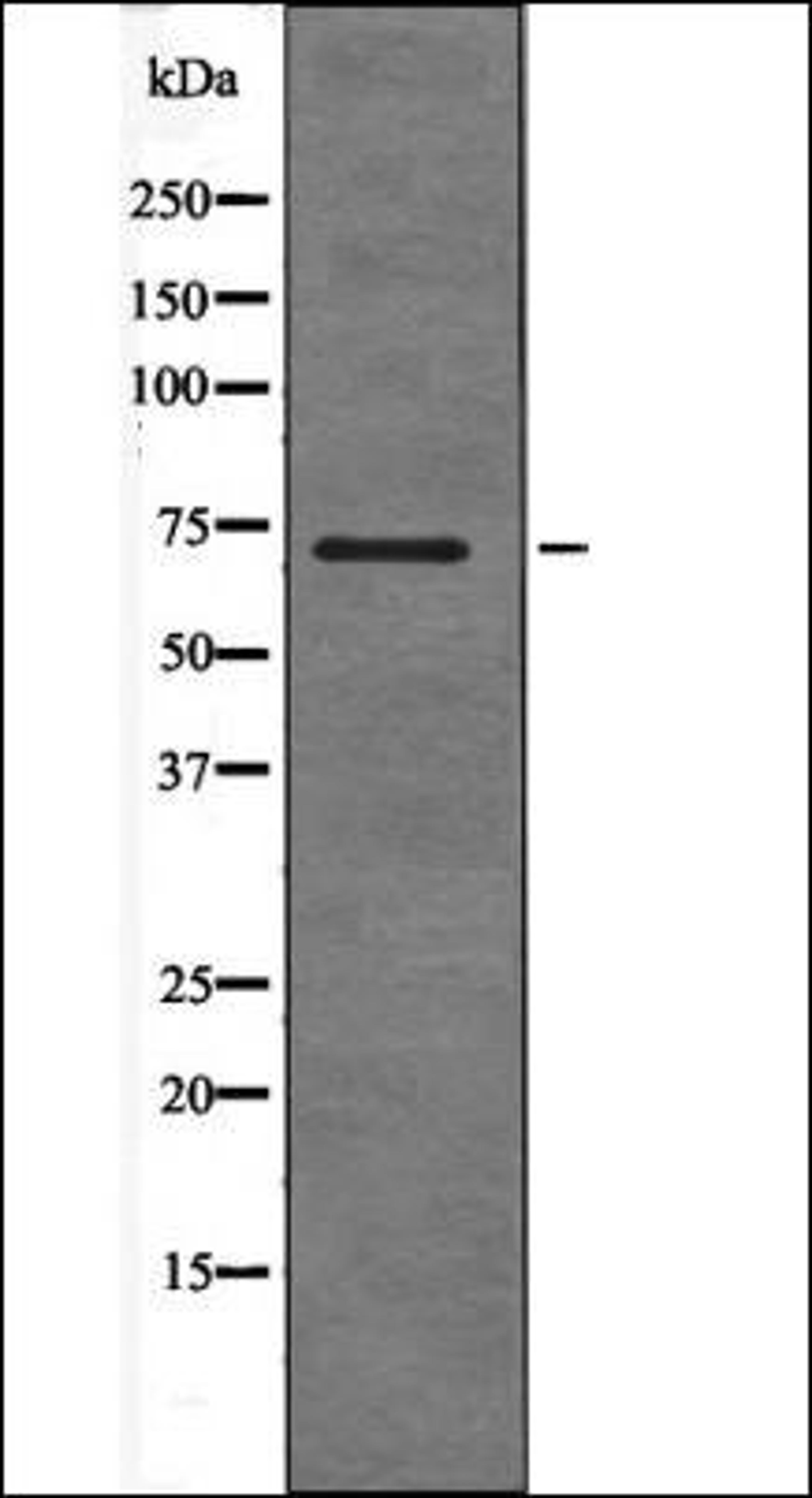 Western blot analysis of EGF treated HepG2 whole cell lysates using SHC -Phospho-Ser36- antibody